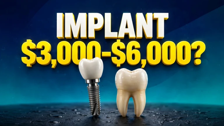 Dental implant cost without insurance — implant model and tooth